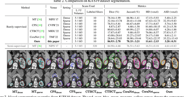 Figure 4 for Orthogonal Annotation Benefits Barely-supervised Medical Image Segmentation