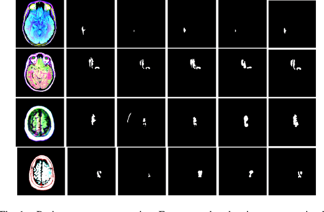 Figure 1 for Segmenting Medical Images: From UNet to Res-UNet and nnUNet