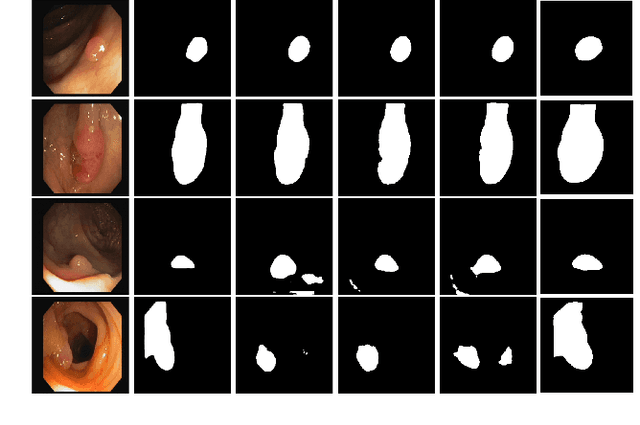 Figure 2 for Segmenting Medical Images: From UNet to Res-UNet and nnUNet