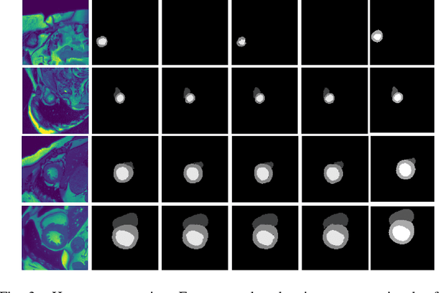 Figure 3 for Segmenting Medical Images: From UNet to Res-UNet and nnUNet