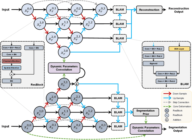 Figure 3 for SRSNetwork: Siamese Reconstruction-Segmentation Networks based on Dynamic-Parameter Convolution