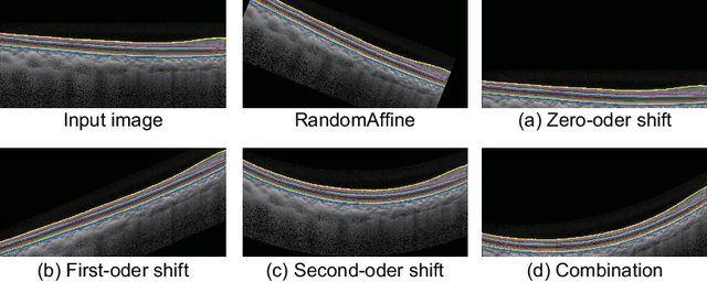 Figure 4 for Formula-Driven Data Augmentation and Partial Retinal Layer Copying for Retinal Layer Segmentation