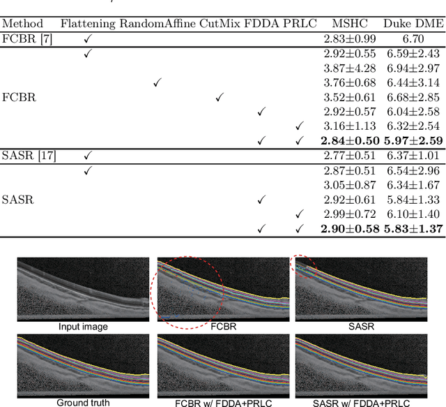 Figure 2 for Formula-Driven Data Augmentation and Partial Retinal Layer Copying for Retinal Layer Segmentation