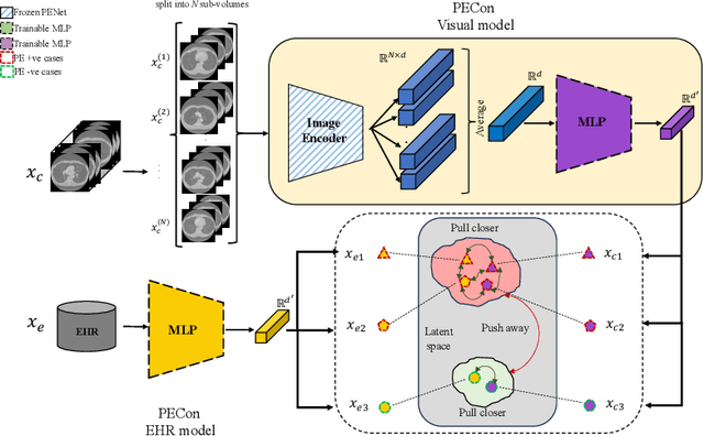 Figure 1 for PECon: Contrastive Pretraining to Enhance Feature Alignment between CT and EHR Data for Improved Pulmonary Embolism Diagnosis