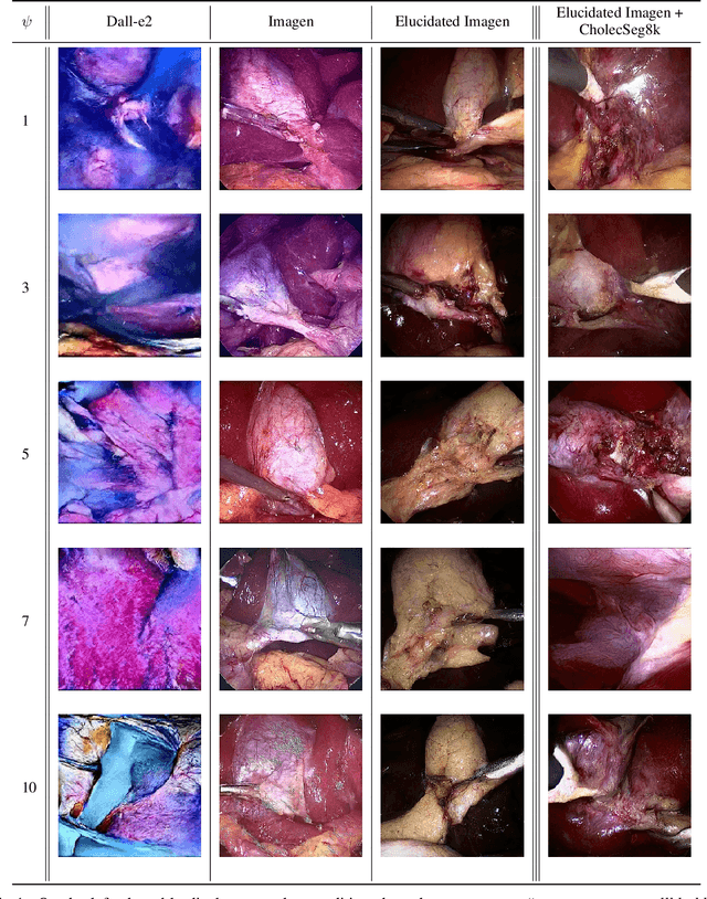 Figure 2 for Navigating the Synthetic Realm: Harnessing Diffusion-based Models for Laparoscopic Text-to-Image Generation