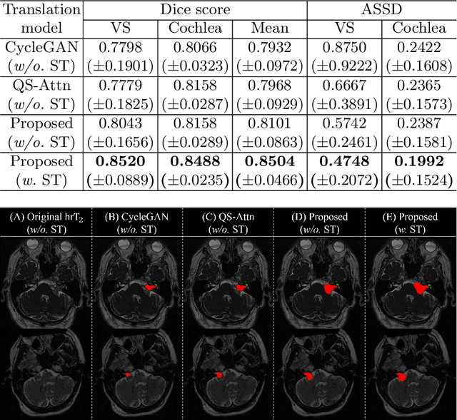 Figure 2 for Multi-view Cross-Modality MR Image Translation for Vestibular Schwannoma and Cochlea Segmentation