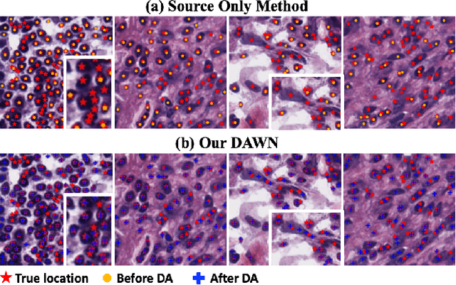 Figure 3 for DAWN: Domain-Adaptive Weakly Supervised Nuclei Segmentation via Cross-Task Interactions