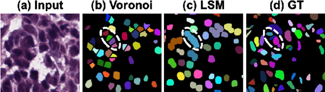 Figure 4 for DAWN: Domain-Adaptive Weakly Supervised Nuclei Segmentation via Cross-Task Interactions