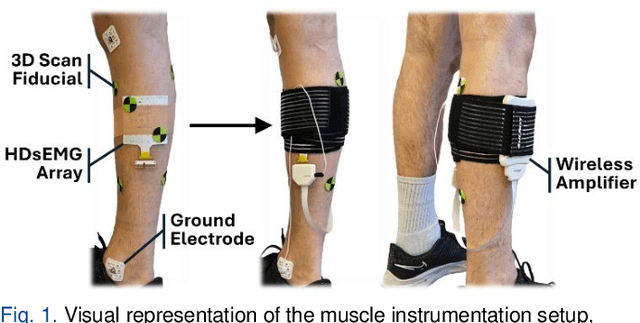 Figure 1 for Characterizing the Effect of Electrode Shift & Sensor Reapplication on Common sEMG Features in Lower Limb Muscles