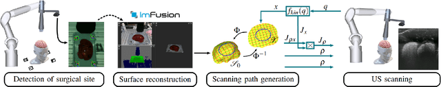 Figure 2 for Automated robotic intraoperative ultrasound for brain surgery