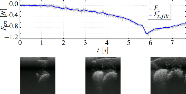 Figure 3 for Automated robotic intraoperative ultrasound for brain surgery