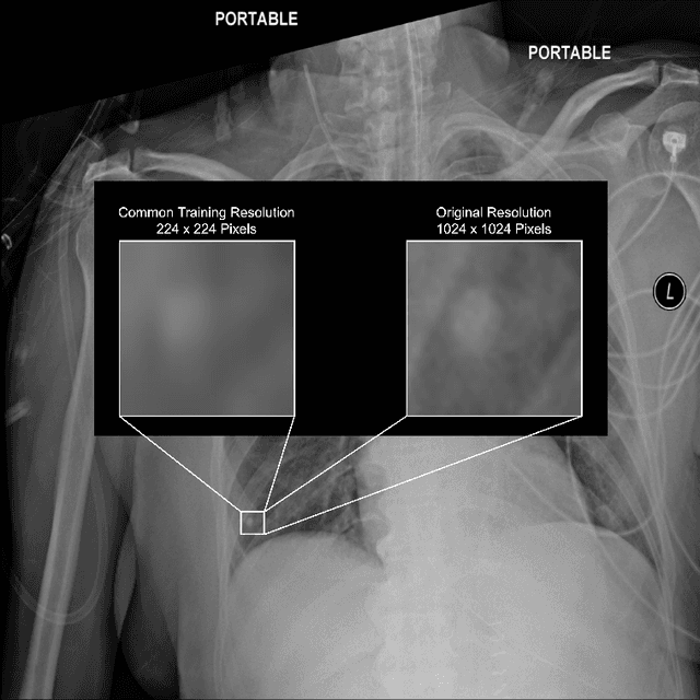 Figure 1 for Exploring the Impact of Image Resolution on Chest X-ray Classification Performance