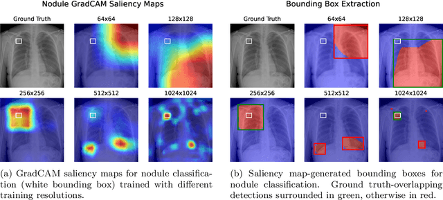 Figure 4 for Exploring the Impact of Image Resolution on Chest X-ray Classification Performance