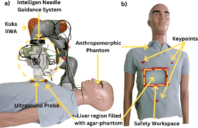 Figure 1 for Preliminary Evaluation of an Ultrasound-Guided Robotic System for Autonomous Percutaneous Intervention