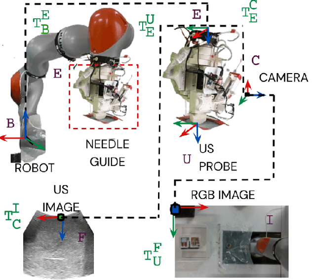 Figure 3 for Preliminary Evaluation of an Ultrasound-Guided Robotic System for Autonomous Percutaneous Intervention