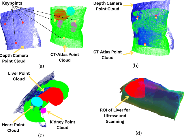 Figure 4 for Preliminary Evaluation of an Ultrasound-Guided Robotic System for Autonomous Percutaneous Intervention