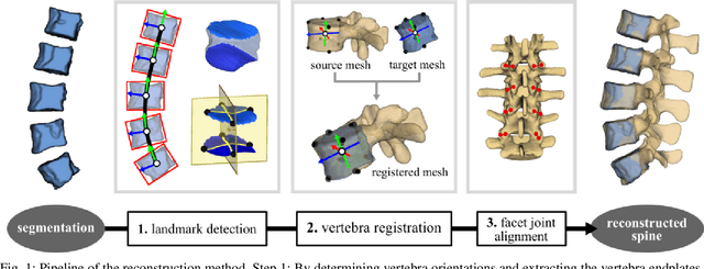 Figure 1 for Reconstruction of 3D lumbar spine models from incomplete segmentations using landmark detection