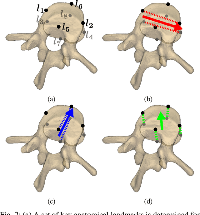 Figure 2 for Reconstruction of 3D lumbar spine models from incomplete segmentations using landmark detection