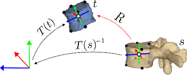 Figure 3 for Reconstruction of 3D lumbar spine models from incomplete segmentations using landmark detection