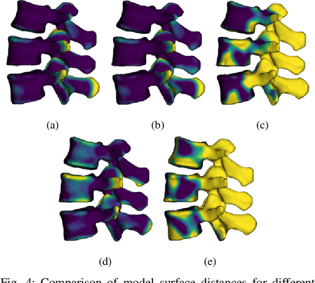 Figure 4 for Reconstruction of 3D lumbar spine models from incomplete segmentations using landmark detection