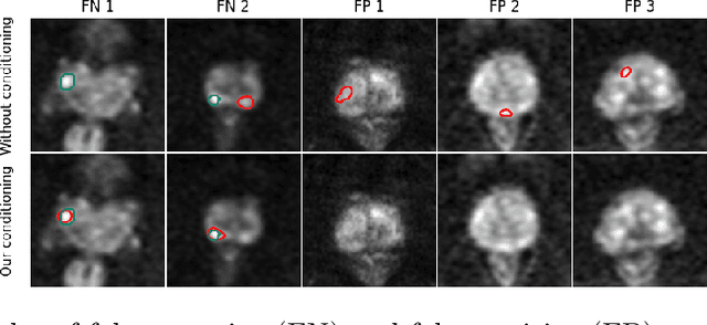 Figure 3 for Decoupled conditional contrastive learning with variable metadata for prostate lesion detection