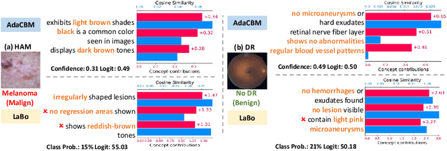 Figure 4 for AdaCBM: An Adaptive Concept Bottleneck Model for Explainable and Accurate Diagnosis