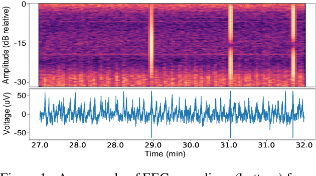 Figure 1 for Multimodal deep learning approach to predicting neurological recovery from coma after cardiac arrest