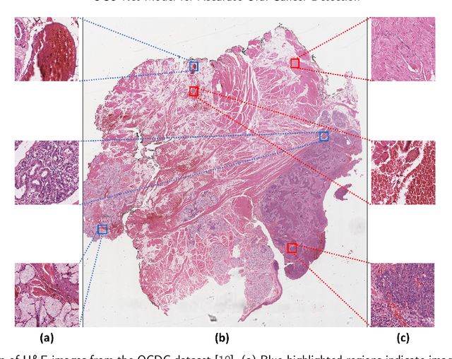 Figure 3 for OCU-Net: A Novel U-Net Architecture for Enhanced Oral Cancer Segmentation