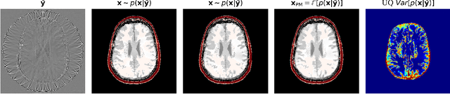 Figure 4 for Amortized Normalizing Flows for Transcranial Ultrasound with Uncertainty Quantification