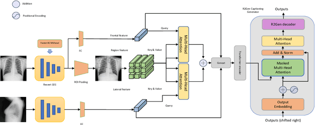 Figure 2 for Self adaptive global-local feature enhancement for radiology report generation