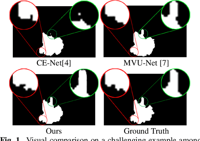 Figure 1 for Adjacent Slice Feature Guided 2.5D Network for Pulmonary Nodule Segmentation