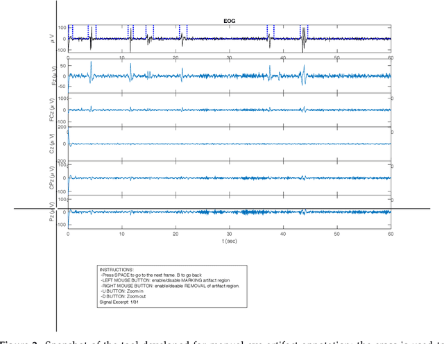 Figure 4 for Preprocessing for lessening the influence of eye artifacts in eeg analysis