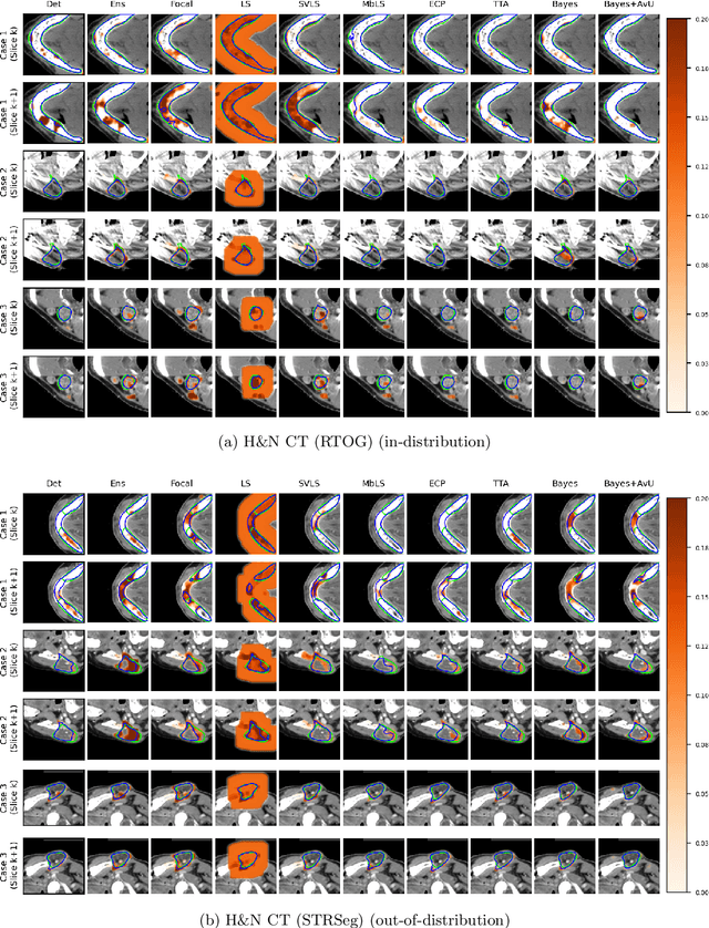 Figure 4 for Improving Uncertainty-Error Correspondence in Deep Bayesian Medical Image Segmentation