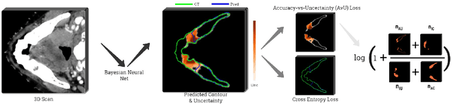 Figure 1 for Improving Uncertainty-Error Correspondence in Deep Bayesian Medical Image Segmentation