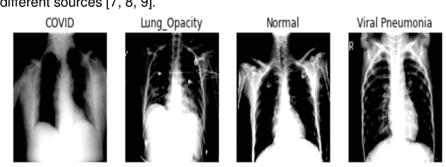 Figure 1 for Deep Learning For Classification Of Chest X-Ray Images