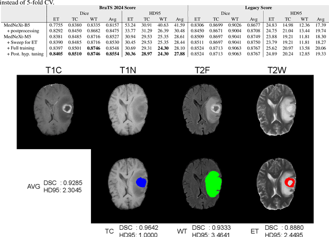 Figure 2 for On Enhancing Brain Tumor Segmentation Across Diverse Populations with Convolutional Neural Networks