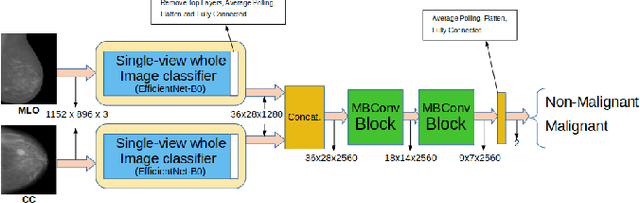 Figure 2 for Optimizing Breast Cancer Detection in Mammograms: A Comprehensive Study of Transfer Learning, Resolution Reduction, and Multi-View Classification