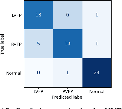 Figure 2 for Multimodal Laryngoscopic Video Analysis for Assisted Diagnosis of Vocal Cord Paralysis