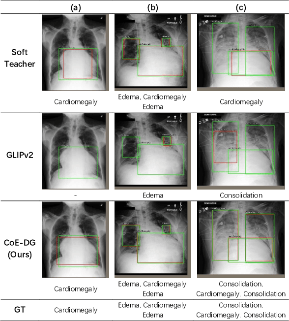 Figure 3 for Unlocking the Potential of Weakly Labeled Data: A Co-Evolutionary Learning Framework for Abnormality Detection and Report Generation