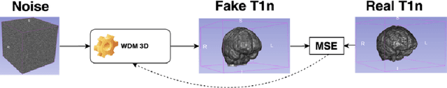 Figure 1 for Brain Tumour Removing and Missing Modality Generation using 3D WDM