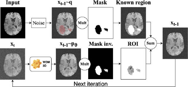 Figure 3 for Brain Tumour Removing and Missing Modality Generation using 3D WDM