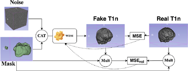 Figure 4 for Brain Tumour Removing and Missing Modality Generation using 3D WDM