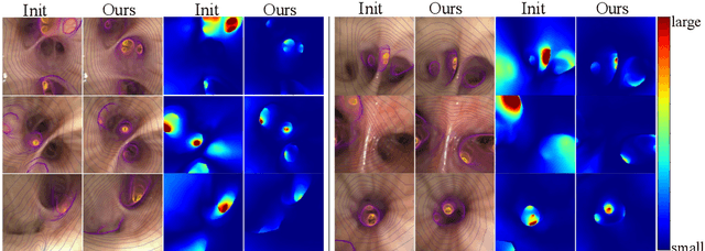 Figure 3 for BronchOpt : Vision-Based Pose Optimization with Fine-Tuned Foundation Models for Accurate Bronchoscopy Navigation