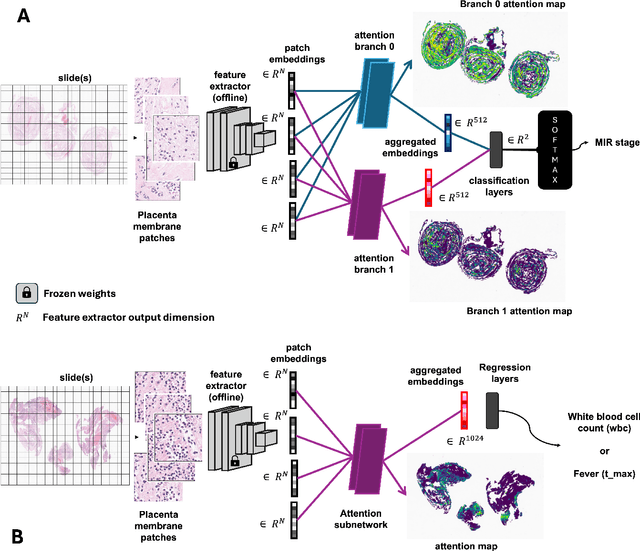 Figure 1 for Machine learning identification of maternal inflammatory response and histologic choroamnionitis from placental membrane whole slide images