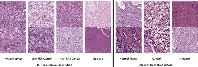 Figure 3 for CLASS-M: Adaptive stain separation-based contrastive learning with pseudo-labeling for histopathological image classification