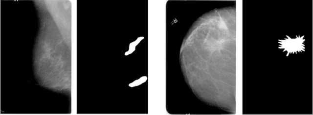 Figure 3 for Enhancing Breast Cancer Diagnosis in Mammography: Evaluation and Integration of Convolutional Neural Networks and Explainable AI