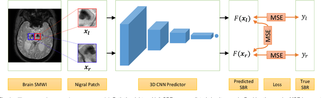 Figure 1 for A Symmetric Regressor for MRI-Based Assessment of Striatal Dopamine Transporter Uptake in Parkinson's Disease