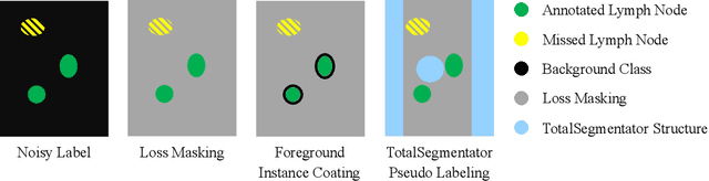 Figure 1 for Mask the Unknown: Assessing Different Strategies to Handle Weak Annotations in the MICCAI2023 Mediastinal Lymph Node Quantification Challenge