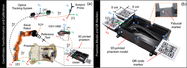 Figure 4 for Augmented Reality and Human-Robot Collaboration Framework for Percutaneous Nephrolithotomy