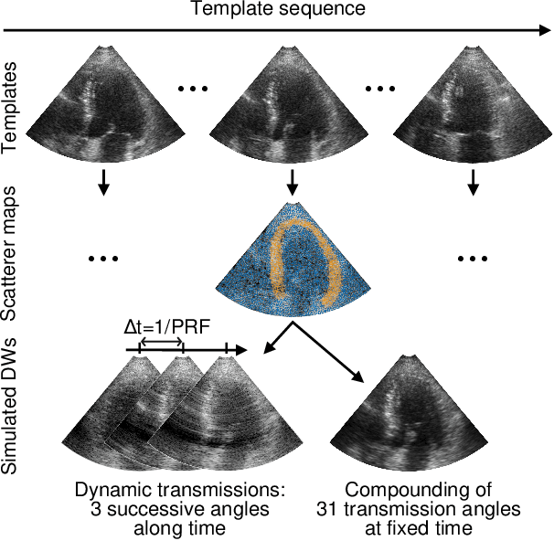 Figure 2 for Ultrafast Cardiac Imaging Using Deep Learning For Speckle-Tracking Echocardiography